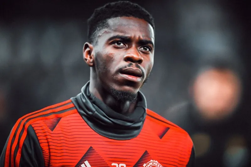 关于图安泽贝起诉曼联索要医疗过失赔偿的信息